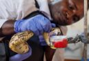 As the world warms, the risk of snakebites is rising